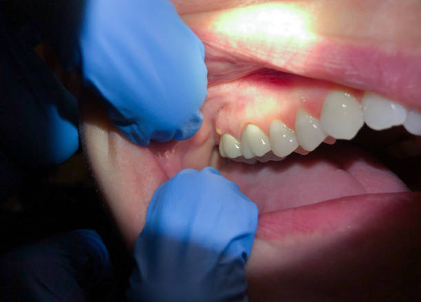 Best Broken or Cracked Tooth Emergency Dentist in Iroquois Point, HI