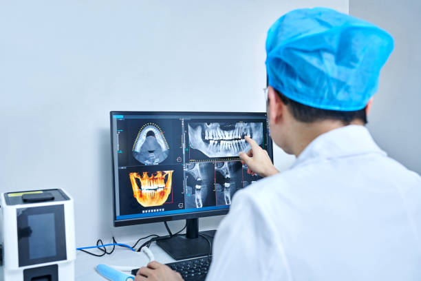 Best Emergency Dentist for Lost Fillings or Crowns in Iroquois Point, HI